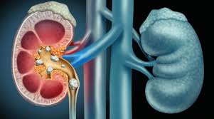 Creatininemia y evaluación de la función renal de filtración glomerular: metodologías y recomendaciones