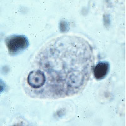 Protozoarios Intestinales